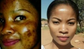 TRADITIONAL HEALER [+27608019525]] ╬ SANGOMA in / spiritual healer & Spell caster in Modimolle, Zebediela, Senwabarwana, Dendron, Naboom , Botokwa, bronkhorstpruit, soshanguve, mamelodi, mabopane, vosloorus, Mafikeng, westenburg, nirvana, bendor, bugersfort, South africa